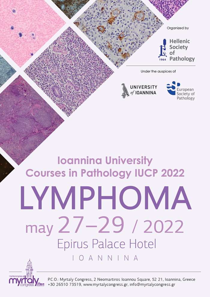 Poster lymphoma